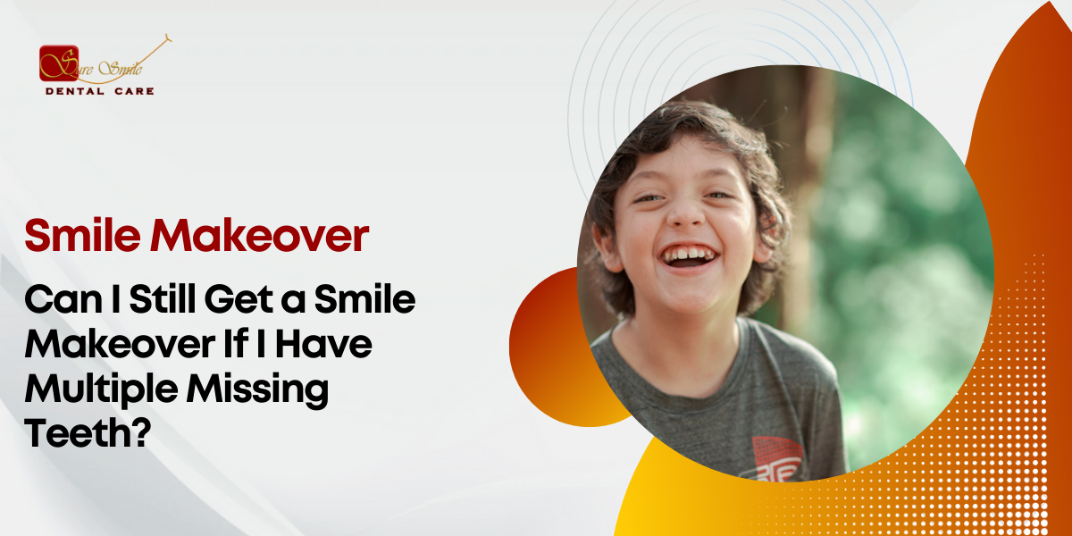 Can I Still Get a Smile Makeover If I Have Multiple Missing Teeth?  