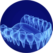 Invisalign-step-02