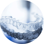 Invisalign-step-03