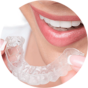 Invisalign-step-04