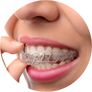 Invisalign-step-06