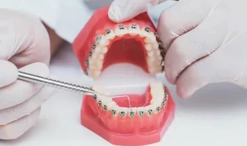 dental-implant-02