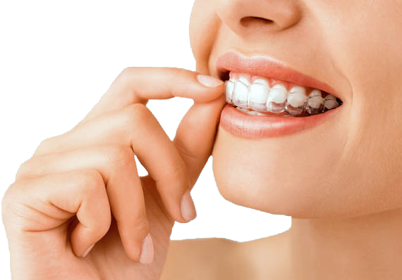 invisalign-dental-implant-01