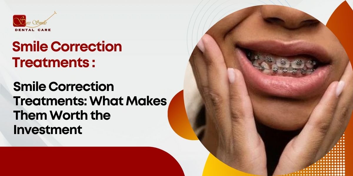 Smile Correction Treatments: What Makes Them Worth the Investment