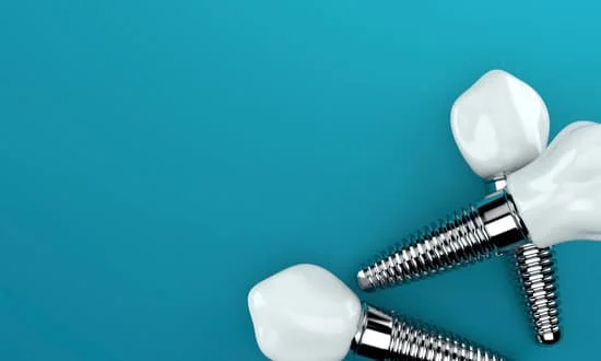 Dental Implants