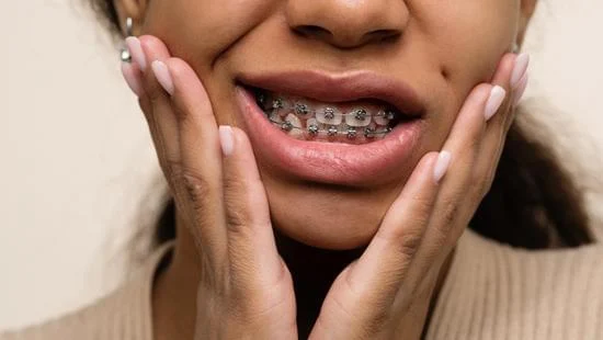 Smile Correction Treatments