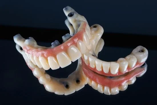 Dental Implants