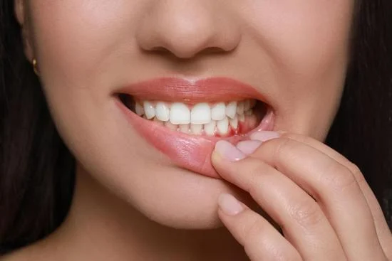 Gum Swelling Treatments