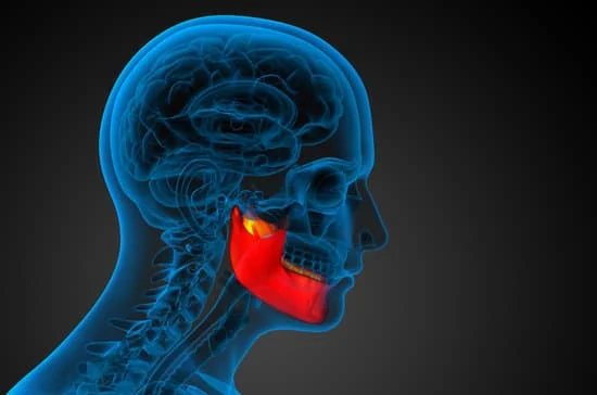 Lower Jaw Surgery