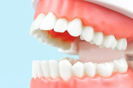 Lower Jaw Surgery
