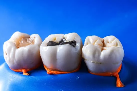 Front Tooth