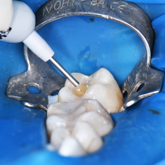 Front Tooth