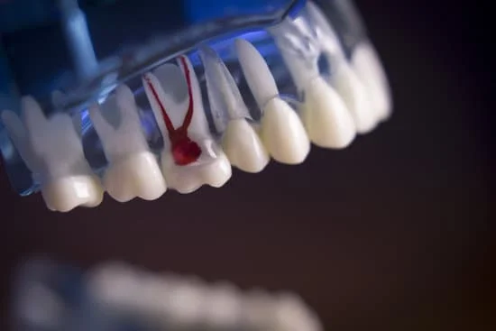 General Dentistry in Bangalore