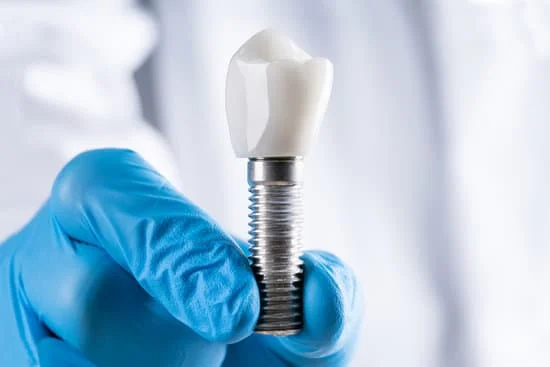 dental implant