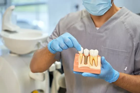 dental implant
