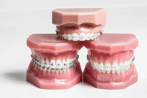orthodontic treatments