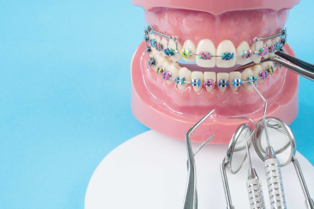 orthodontic treatments