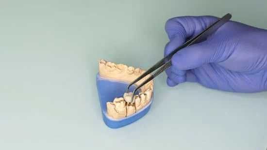 full mouth reconstruction in bangalore