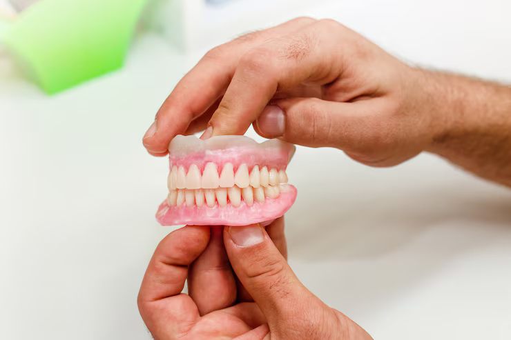 full mouth dental implants