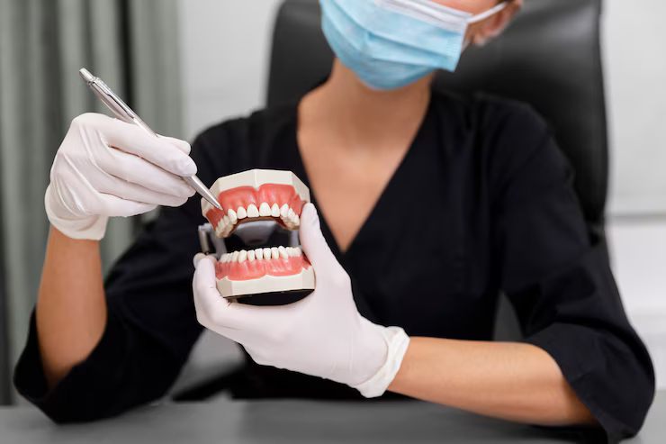 full mouth dental implants