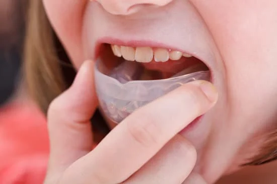 smile correction treatment