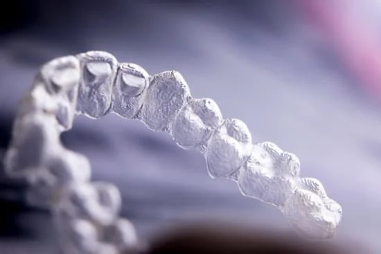 invisalign dentist in horamavu