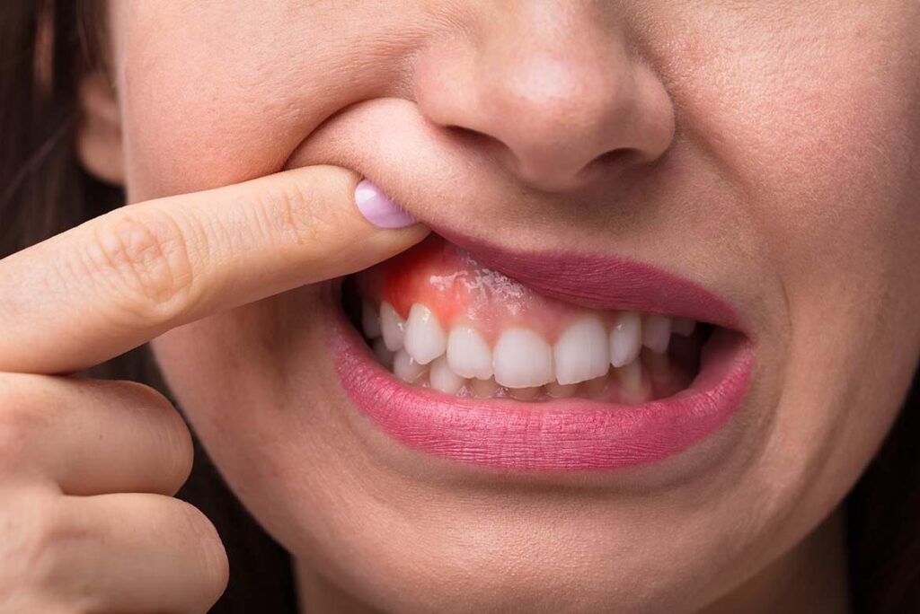 gum disease treatment