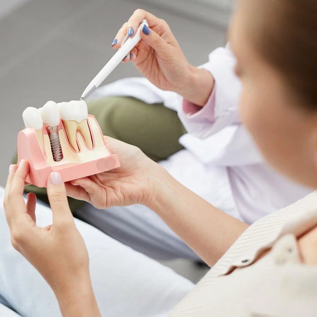 dental implants