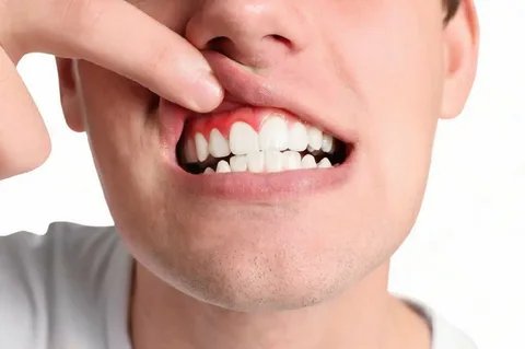 gum disease treatment