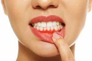 gum disease treatment