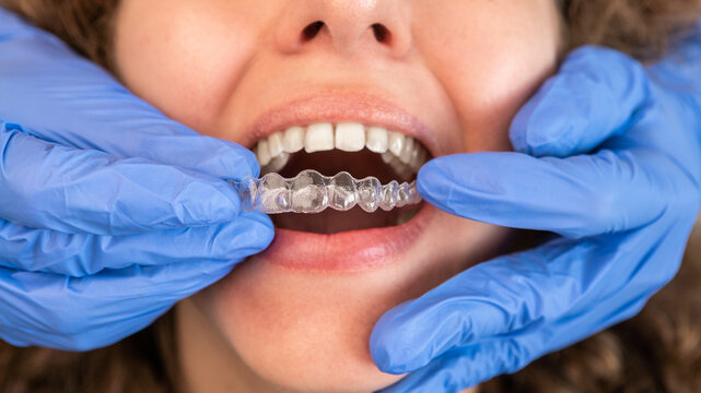 Invisalign dentist Near Me