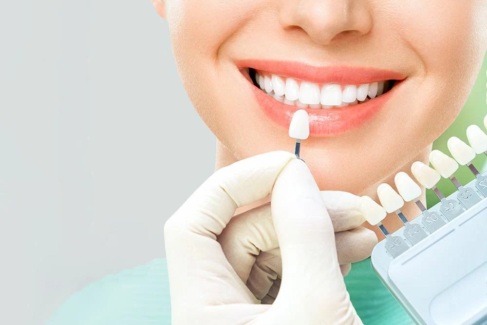 smile correction treatment