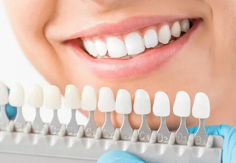 smile correction treatment