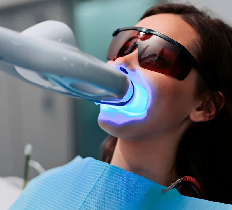 teeth whitening treatment