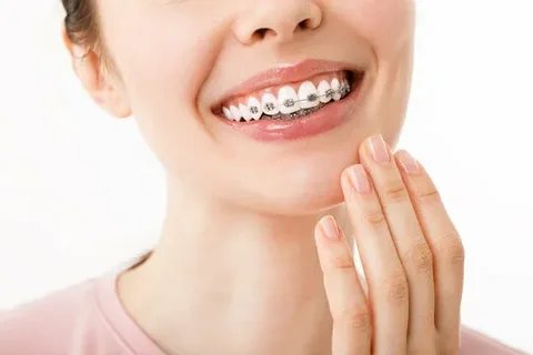 smile correction treatment