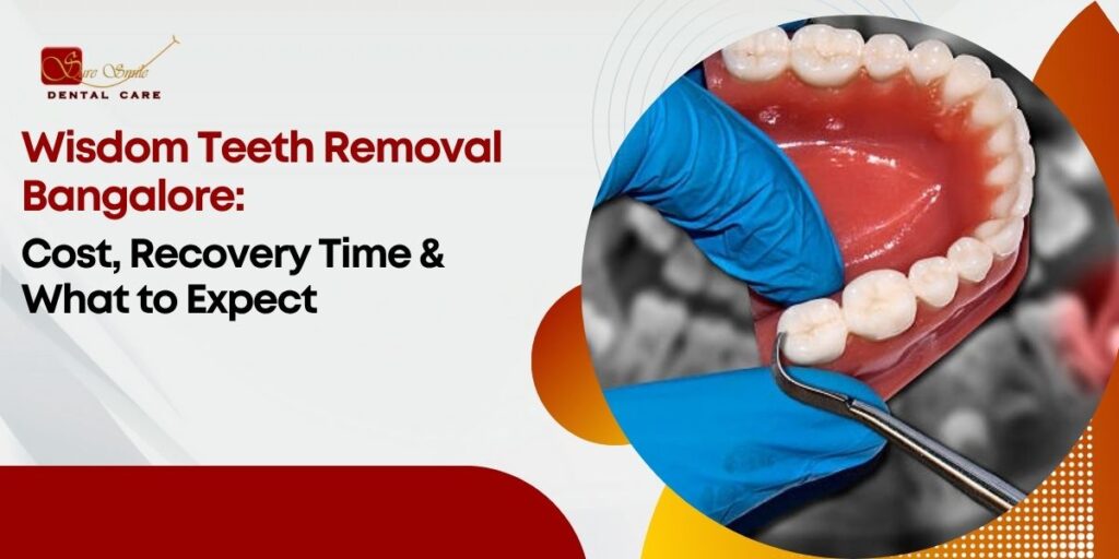 Wisdom teeth removal Bangalore