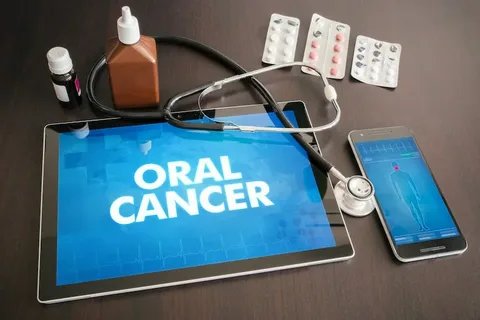 Oral cancer screening Bangalore