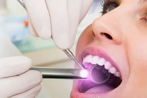 Oral cancer screening Bangalore