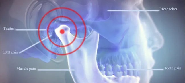 TMJ treatment Bangalore