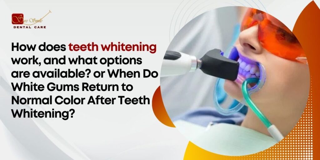 Teeth Whitening