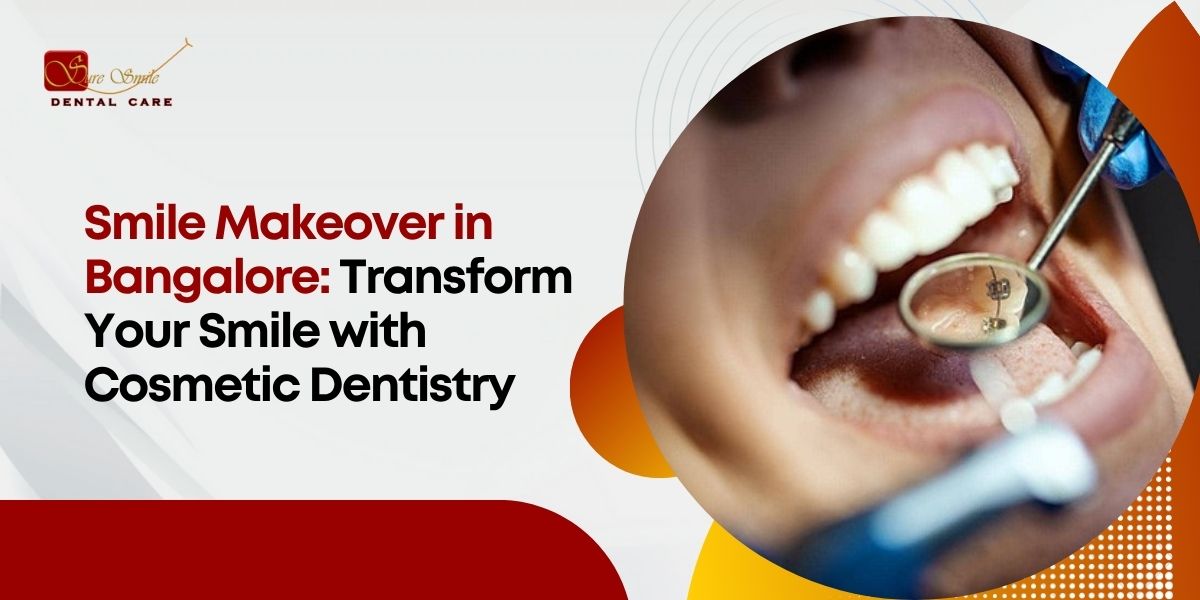 Smile Makeover in Bangalore: Transform Your Smile with Cosmetic Dentistry 