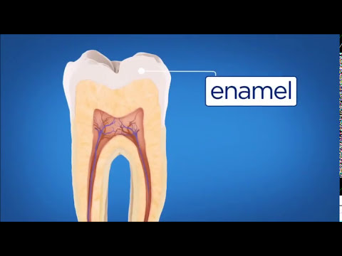 stages of tooth decay