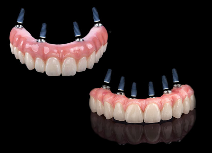 Dental implantologist