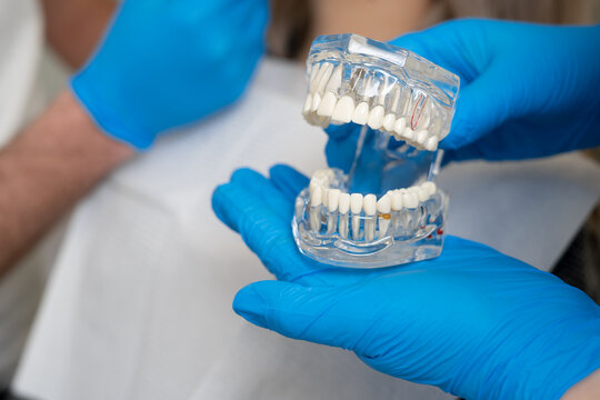 Dental implantologist