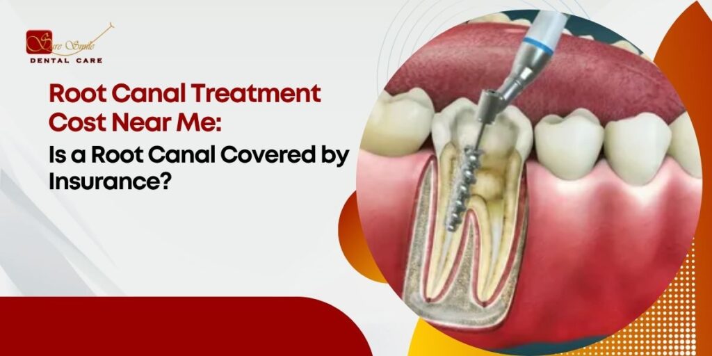 root canal treatment cost near me