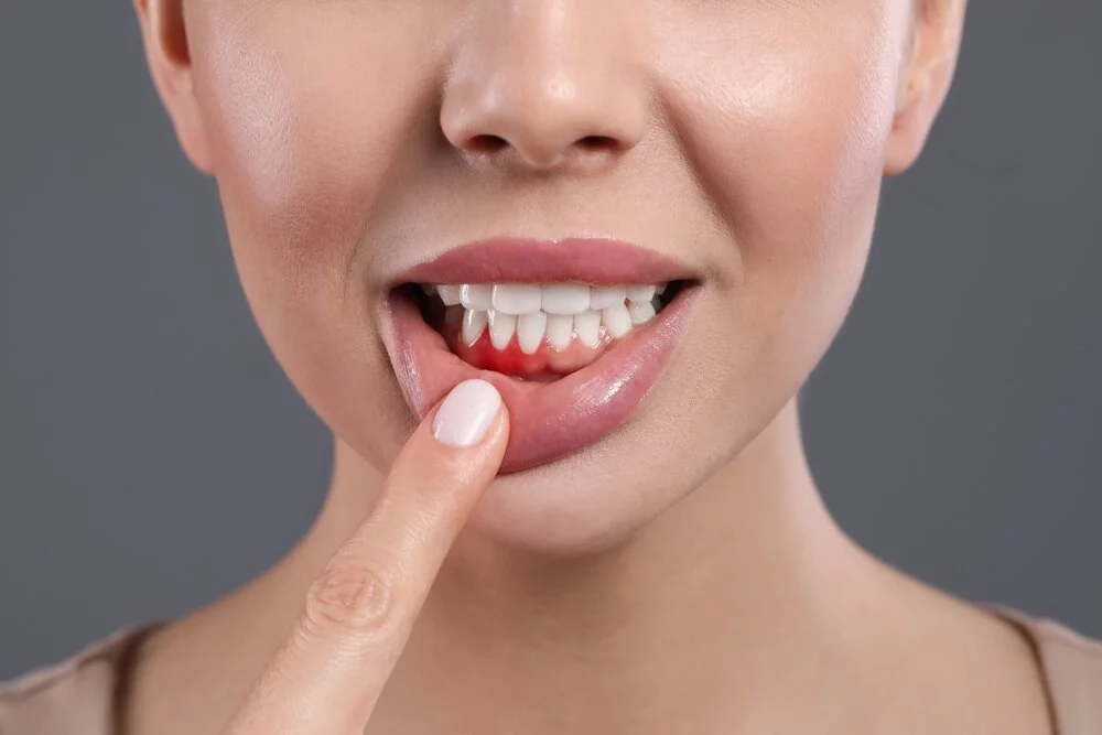 Gum Disease Treatment