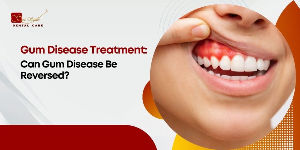 Gum Disease Treatment