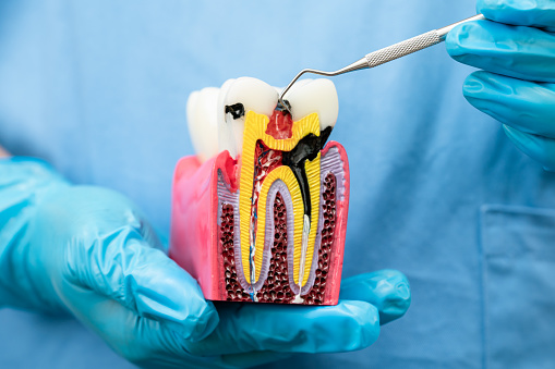 Dental treatment in bangalore