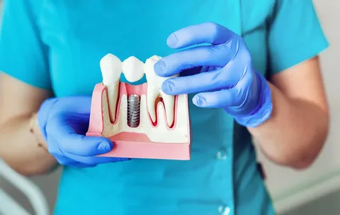Dental Treatment Cost India vs US UK