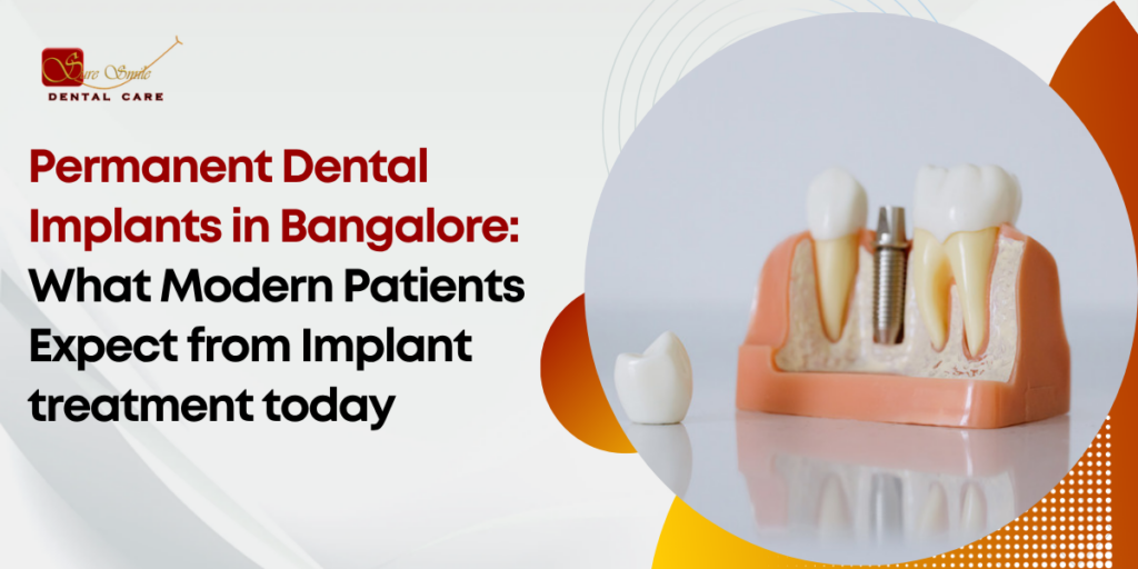 Permanent Dental Implants